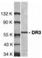 TNF Receptor Superfamily Member 25 antibody, A03227-1, Boster Biological Technology, Western Blot image 
