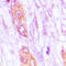 Maternal Embryonic Leucine Zipper Kinase antibody, LS-C354135, Lifespan Biosciences, Immunohistochemistry paraffin image 