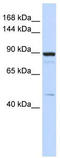 cGMP-inhibited 3 ,5 -cyclic phosphodiesterase B antibody, TA335263, Origene, Western Blot image 