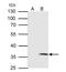 B36-VDAC antibody, NBP2-20849, Novus Biologicals, Immunoprecipitation image 