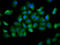 Ubiquitin thioesterase OTU1 antibody, LS-C681714, Lifespan Biosciences, Immunofluorescence image 