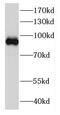 DEAD-Box Helicase 27 antibody, FNab02303, FineTest, Western Blot image 