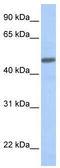 CALCRL antibody, TA346420, Origene, Western Blot image 