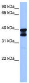 Solute Carrier Family 25 Member 31 antibody, TA335435, Origene, Western Blot image 