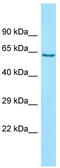 Ankyrin Repeat And FYVE Domain Containing 1 antibody, TA331370, Origene, Western Blot image 