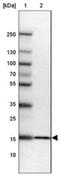Ribosomal Protein S23 antibody, NBP2-30412, Novus Biologicals, Western Blot image 