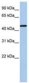 Purinergic Receptor P2X 2 antibody, TA338565, Origene, Western Blot image 