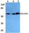Solute Carrier Family 43 Member 1 antibody, A10910, Boster Biological Technology, Western Blot image 