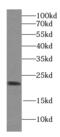 Hippocalcin-like protein 1 antibody, FNab09404, FineTest, Western Blot image 