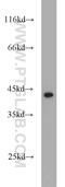 DEP domain-containing mTOR-interacting protein antibody, 20985-1-AP, Proteintech Group, Western Blot image 