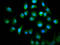Kinesin Family Member 18A antibody, LS-C680707, Lifespan Biosciences, Immunofluorescence image 