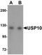 Ubiquitin Specific Peptidase 10 antibody, orb94528, Biorbyt, Western Blot image 