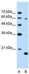 Solute Carrier Family 38 Member 4 antibody, TA344147, Origene, Western Blot image 
