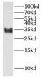 IMP U3 Small Nucleolar Ribonucleoprotein 4 antibody, FNab04298, FineTest, Western Blot image 