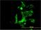 Centromere Protein K antibody, H00064105-M01, Novus Biologicals, Immunofluorescence image 