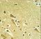 Proteasomal ATPase Associated Factor 1 antibody, LS-C163330, Lifespan Biosciences, Immunohistochemistry paraffin image 