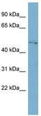 Glycoprotein-N-acetylgalactosamine 3-beta-galactosyltransferase 1 antibody, TA338405, Origene, Western Blot image 