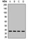 Thymidylate Synthetase antibody, orb411773, Biorbyt, Western Blot image 