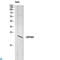CKLF Like MARVEL Transmembrane Domain Containing 8 antibody, LS-C813382, Lifespan Biosciences, Immunohistochemistry paraffin image 