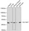 Solute Carrier Family 16 Member 7 antibody, GTX64816, GeneTex, Western Blot image 