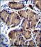 Hepatic lipase antibody, PA5-71668, Invitrogen Antibodies, Immunohistochemistry frozen image 