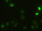 Actinin Alpha 1 antibody, GTX84959, GeneTex, Immunofluorescence image 