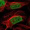 Zinc Finger Protein 532 antibody, PA5-53300, Invitrogen Antibodies, Immunofluorescence image 