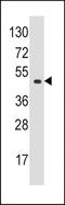 Eukaryotic Translation Initiation Factor 4A1 antibody, TA302076, Origene, Western Blot image 