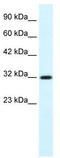 Collagen Like Tail Subunit Of Asymmetric Acetylcholinesterase antibody, TA335707, Origene, Western Blot image 