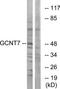Glucosaminyl (N-Acetyl) Transferase Family Member 7 antibody, TA316125, Origene, Western Blot image 