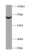 Bridging Integrator 1 antibody, FNab00897, FineTest, Western Blot image 