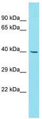 Chromosome 7 Open Reading Frame 26 antibody, TA330726, Origene, Western Blot image 