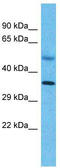Small Nuclear RNA Activating Complex Polypeptide 2 antibody, TA341731, Origene, Western Blot image 