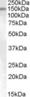 SUMO Specific Peptidase 6 antibody, TA303331, Origene, Western Blot image 