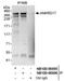Ankyrin Repeat Domain 17 antibody, NB100-86996, Novus Biologicals, Western Blot image 