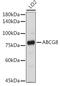 ATP Binding Cassette Subfamily G Member 8 antibody, GTX65624, GeneTex, Western Blot image 