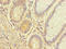 UDP-N-acetylglucosamine transferase subunit ALG14 homolog antibody, LS-C378859, Lifespan Biosciences, Immunohistochemistry paraffin image 