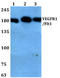 Fms Related Tyrosine Kinase 1 antibody, AP06592PU-N, Origene, Western Blot image 
