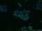 Aldehyde Dehydrogenase 1 Family Member A1 antibody, 15910-1-AP, Proteintech Group, Immunofluorescence image 