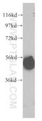 Probable serine carboxypeptidase CPVL antibody, 12548-1-AP, Proteintech Group, Western Blot image 