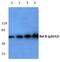 RELB Proto-Oncogene, NF-KB Subunit antibody, PA5-36837, Invitrogen Antibodies, Western Blot image 