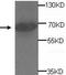 ADAM Metallopeptidase Domain 20 antibody, TA310090, Origene, Western Blot image 