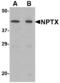 Neuronal pentraxin-2 antibody, LS-B2694, Lifespan Biosciences, Western Blot image 