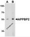 Amyloid Beta Precursor Protein Binding Protein 2 antibody, 7563, ProSci Inc, Western Blot image 