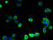 Secretory Carrier Membrane Protein 2 antibody, A63374-100, Epigentek, Immunofluorescence image 