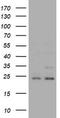 RAB21, Member RAS Oncogene Family antibody, TA505776S, Origene, Western Blot image 