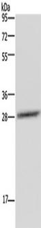 CCAAT Enhancer Binding Protein Delta antibody, TA322658, Origene, Western Blot image 