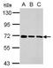 Transmembrane Protein 259 antibody, GTX118618, GeneTex, Western Blot image 