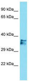 Clathrin Binding Box Of Aftiphilin Containing 1 antibody, TA333454, Origene, Western Blot image 