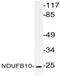 NADH:Ubiquinone Oxidoreductase Subunit B10 antibody, AP21066PU-N, Origene, Western Blot image 